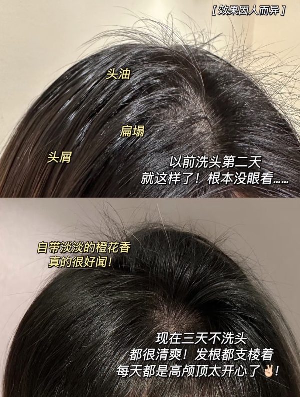 KÉRASTASE 卡詩 極淨平衡頭皮凝露 200ml：圖片 4